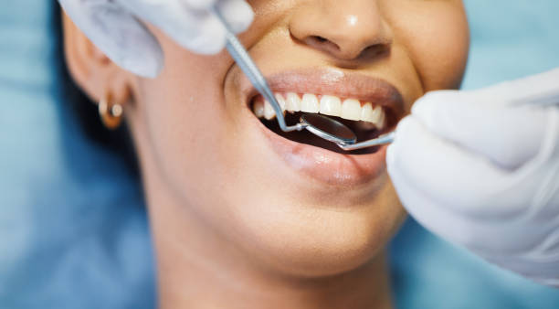 Best Emergency Denture Repair in Johnson City, TN