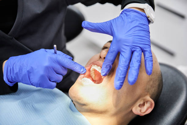 Best Emergency Treatment for Dental Infections or Abscesses in Johnson City, TN